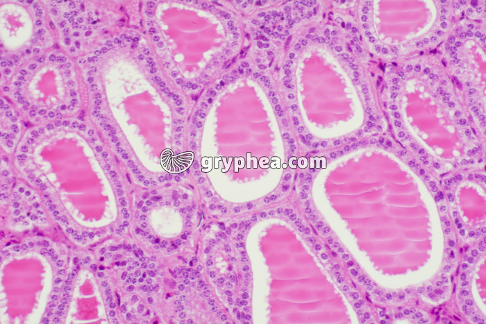 Thyroïde - Epithélium cubique x100 - gryphea.com